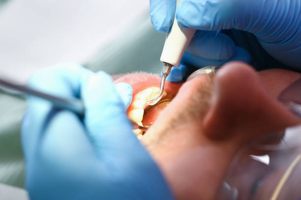 Best Emergency Dental Care for Abscessed Tooth in Chelsea, OK