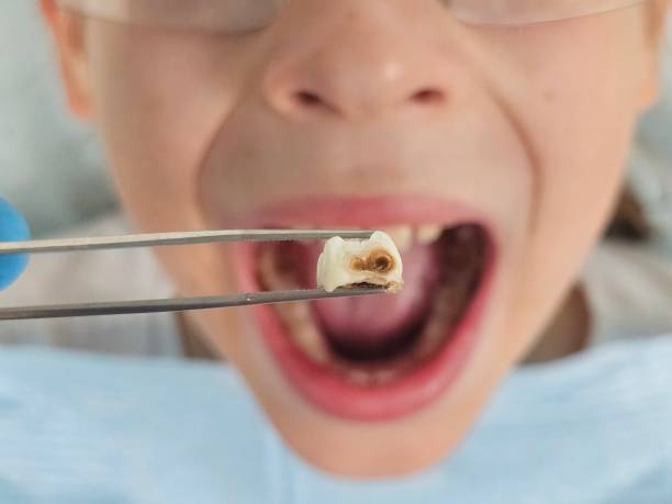 Best Pediatric Emergency Dentist in Chelsea, OK